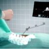 Microsoft HoloLens becomes an AR assistant for spinal surgery 600